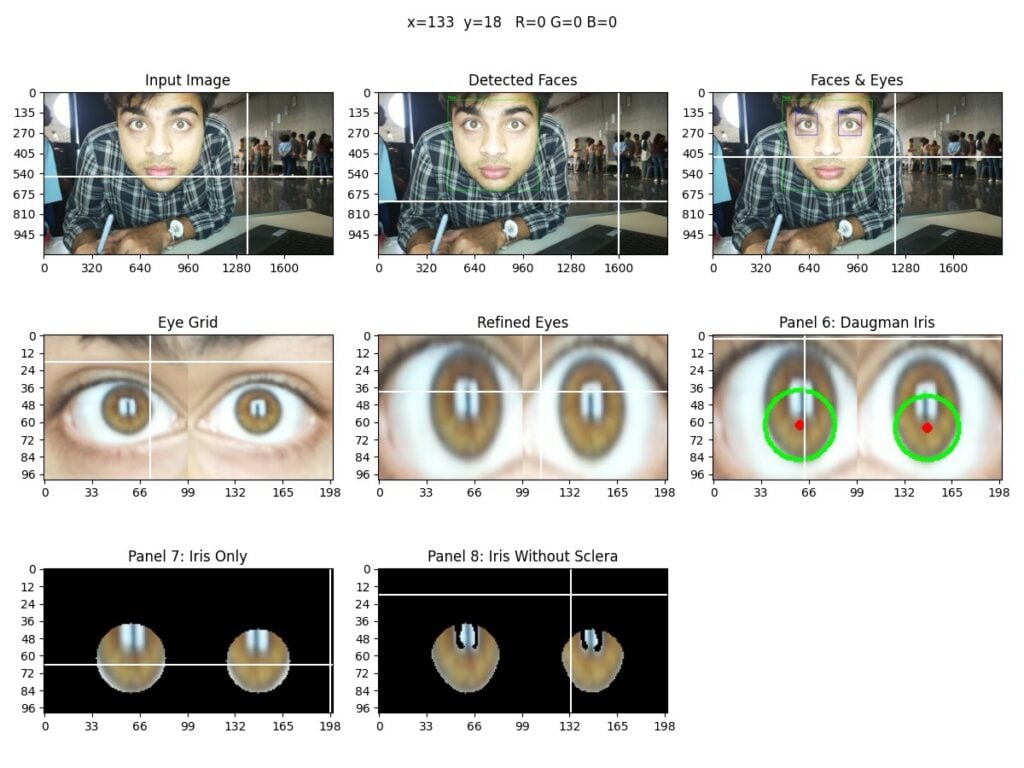 Iris Colour Detection with Raspberry Pi